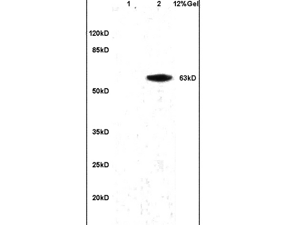 Lane 1: mouse brain lysates Lane 2: human colon carcinoma lysates probed with Anti alpha Actinin PGRN/Granulin Polyclonal Antibody, Unconjugated (bs-0823R) at 1:200 in 4˚C. Followed by conjugation to secondary antibody (bs-0295G-HRP) at 1:3000 90min in 37˚C. Predicted band 63kD. Observed band size: 63kD.