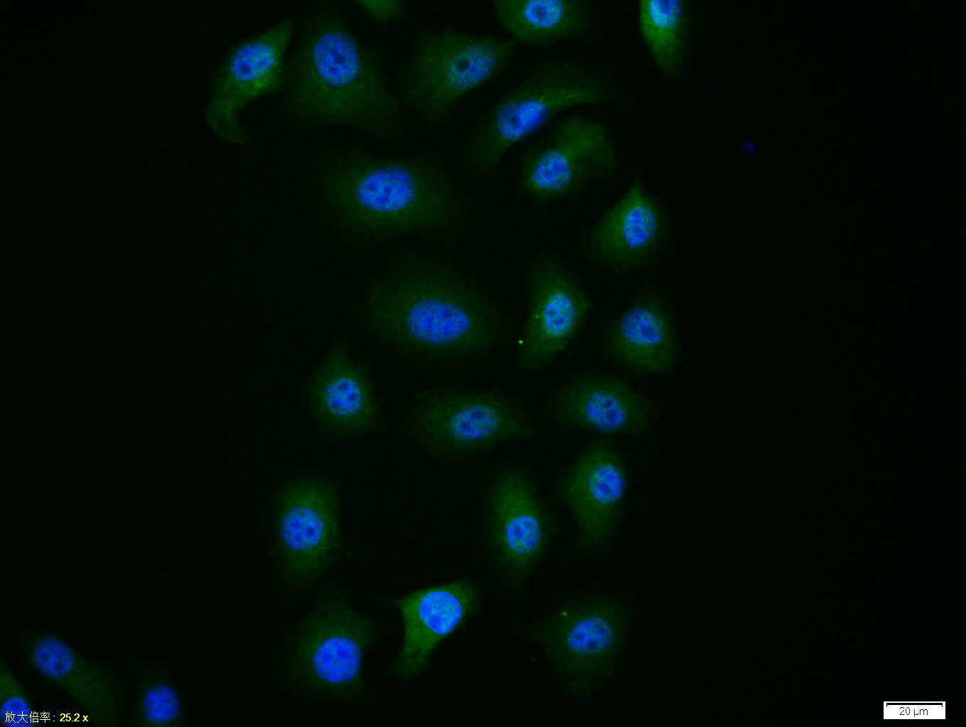 HepG2 cell; 4% Paraformaldehyde-fixed; Triton X-100 at room temperature for 20 min; Blocking buffer (normal goat serum, C-0005) at 37°C for 20 min; Antibody incubation with (Caspase-9) polyclonal Antibody, Unconjugated (bs-20773R) 1:100, 90 minutes at 37°C; followed by a conjugated Goat Anti-Rabbit IgG antibody at 37°C for 90 minutes, DAPI (blue, C02-04002) was used to stain the cell nuclei.