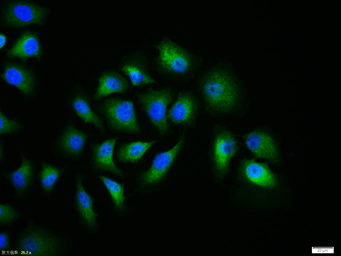 HepG2 cell; 4% Paraformaldehyde-fixed; Triton X-100 at room temperature for 20 min; Blocking buffer (normal goat serum, C-0005) at 37°C for 20 min; Antibody incubation with (Caspase-9) polyclonal Antibody, Unconjugated (bs-0049R) 1:100, 90 minutes at 37°C; followed by a conjugated Goat Anti-Rabbit IgG antibody at 37°C for 90 minutes, DAPI (blue, C02-04002) was used to stain the cell nuclei.