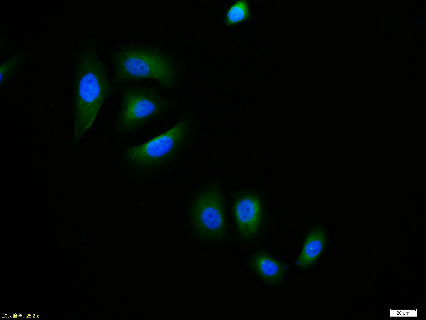 HepG2 cell; 4% Paraformaldehyde-fixed; Triton X-100 at room temperature for 20 min; Blocking buffer (normal goat serum, C-0005) at 37\u00b0C for 20 min; Antibody incubation with (phospho-IKB alpha (Ser32 + Ser36)) polyclonal Antibody, Unconjugated (bs-2513R) 1:100, 90 minutes at 37\u00b0C; followed by a conjugated Goat Anti-Rabbit IgG antibody at 37\u00b0C for 90 minutes, DAPI (blue, C02-04002) was used to stain the cell nuclei.