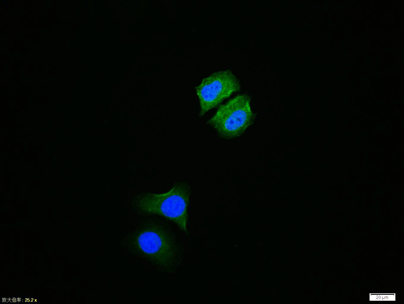 HepG2 cell; 4% Paraformaldehyde-fixed; Triton X-100 at room temperature for 20 min; Blocking buffer (normal goat serum, C-0005) at 37°C for 20 min; Antibody incubation with (phospho-IKB alpha (Ser36)) polyclonal Antibody, Unconjugated (bs-18129R) 1:100, 90 minutes at 37°C; followed by a conjugated Goat Anti-Rabbit IgG antibody at 37°C for 90 minutes, DAPI (blue, C02-04002) was used to stain the cell nuclei.