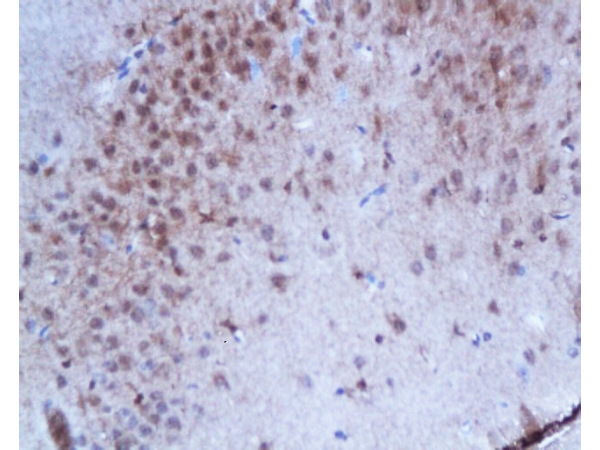 Formalin-fixed and paraffin embedded rat brain tissue with labeled Anti-Phospho-Estrogen Receptor alpha (Ser167) Polyclonal Antibody, Unconjugated (bs-0894R) at 1:200, followed by conjugation to the secondary antibody and DAB staining