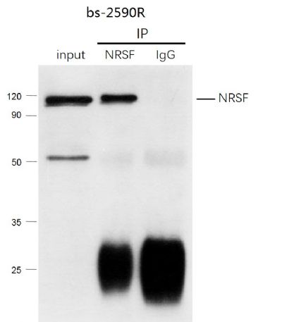 Lane 1: human hela cell lysates; Lane 2: bs-2590R IP in human hela cell lysates; Lane 3: native rabbit IgG IP in human hela cell lysates probed with NRSF/REST Polyclonal Antibody, Unconjugated (bs-2590R) at 1:150 dilution and 4˚C overnight incubation. Followed by conjugated secondary antibody incubation at 1:20000 for 60 min at 37˚C.