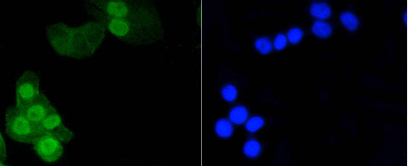 CRC cell; 4% Paraformaldehyde-fixed; Triton X-100 at room temperature for 20 min; Blocking buffer (normal goat serum, C-0005) at 37°C for 20 min; Antibody incubation with (Phospho-Histone H1.3(T17)+Histone H1.4(T17)) Monoclonal Antibody, Unconjugated (bsm-54480R) 1:100, 90 minutes at 37°C; followed by a conjugated Goat Anti-Rabbit IgG antibody at 37°C for 90 minutes, DAPI (blue, C02-04002) was used to stain the cell nuclei.