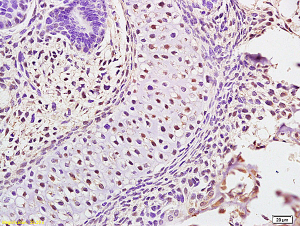 Formalin-fixed and paraffin embedded mouse embryo labeled with Anti ATAD5 Polyclonal Antibody,Unconjugated (bs-7656R) at 1:200 followed by conjugation to the secondary antibody and DAB staining.