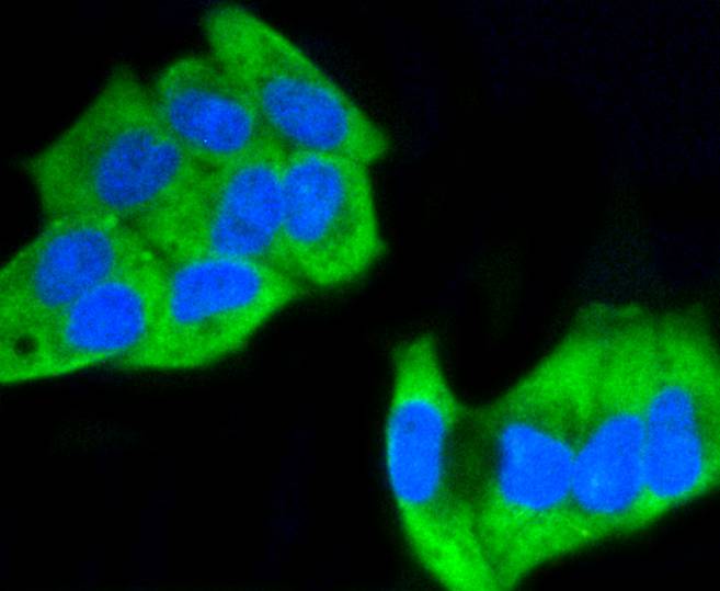 Hela cell; 4% Paraformaldehyde-fixed; Triton X-100 at room temperature for 20 min; Blocking buffer (normal goat serum) at 37°C for 20 min; Antibody incubation with (Phospho-MEK1(S218/S222)) Monoclonal Antibody, Unconjugated (bsm-54527R) 1:50, 90 minutes at 37°C; followed by a conjugated Goat Anti-Rabbit IgG antibody at 37°C for 90 minutes, DAPI (blue) was used to stain the cell nuclei.