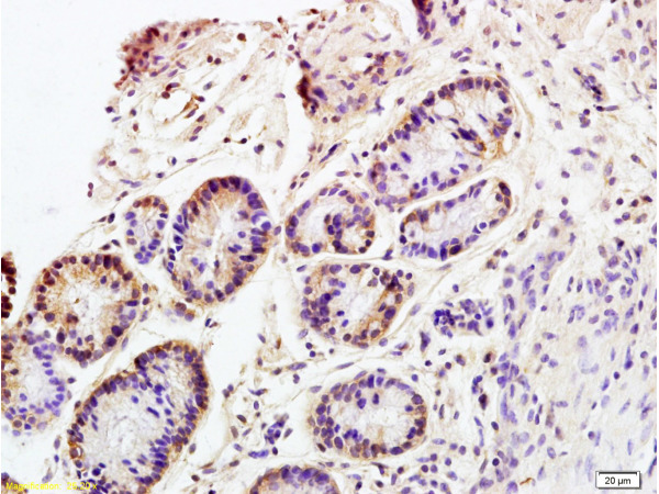 Formalin-fixed and paraffin embedded rat colitis tissue labeled with Anti CD98 Polyclonal Antibody, Unconjugated (bs-6659R) at 1:200 followed by conjugation to the secondary antibody and DAB staining