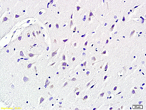Formalin-fixed and paraffin embedded rat brain labeled with Anti KCNN4 Polyclonal Antibody, Unconjugated (bs-6675R) at 1:200 followed by conjugation to the secondary antibody and DAB staining