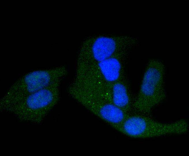 Hela cell; 4% Paraformaldehyde-fixed; Triton X-100 at room temperature for 20 min; Blocking buffer (normal goat serum) at 37°C for 20 min; Antibody incubation with (Phospho-PKA R2 (S99)) Monoclonal Antibody, Unconjugated (bsm-54545R) 1:50, 90 minutes at 37°C; followed by a conjugated Goat Anti-Rabbit IgG antibody at 37°C for 90 minutes, DAPI (blue) was used to stain the cell nuclei.