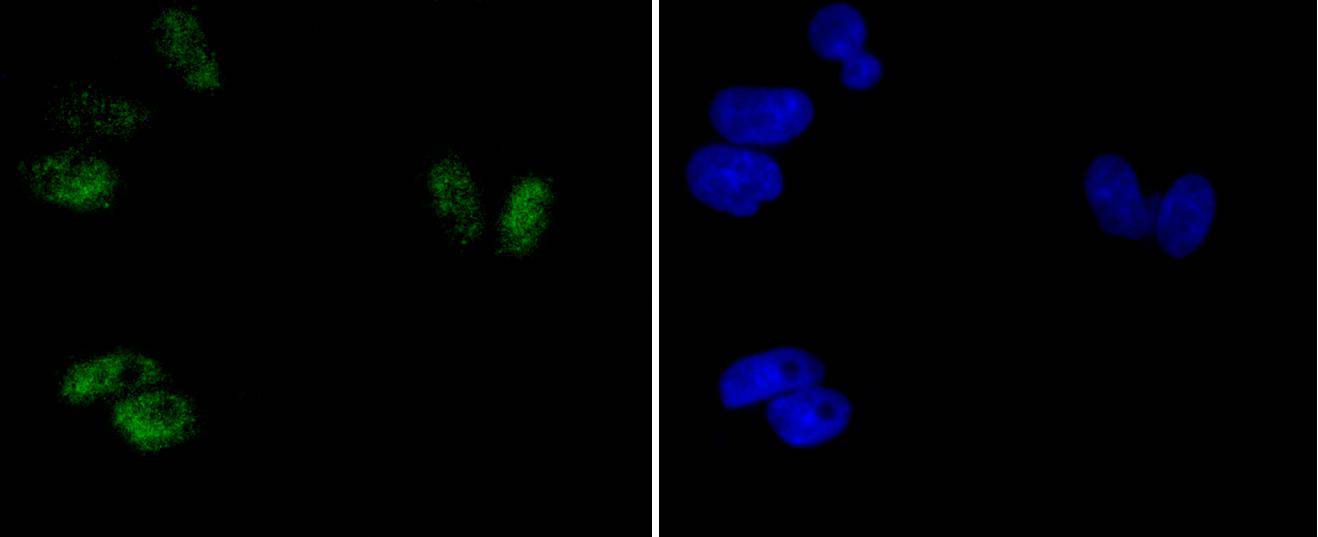 Hela cell; 4% Paraformaldehyde-fixed; Triton X-100 at room temperature for 20 min; Blocking buffer (normal goat serum) at 37°C for 20 min; Antibody incubation with (Phospho-ATF2(T71)) Monoclonal Antibody, Unconjugated (bsm-54546R) 1:50, 90 minutes at 37°C; followed by a conjugated Goat Anti-Rabbit IgG antibody at 37°C for 90 minutes, DAPI (blue) was used to stain the cell nuclei.