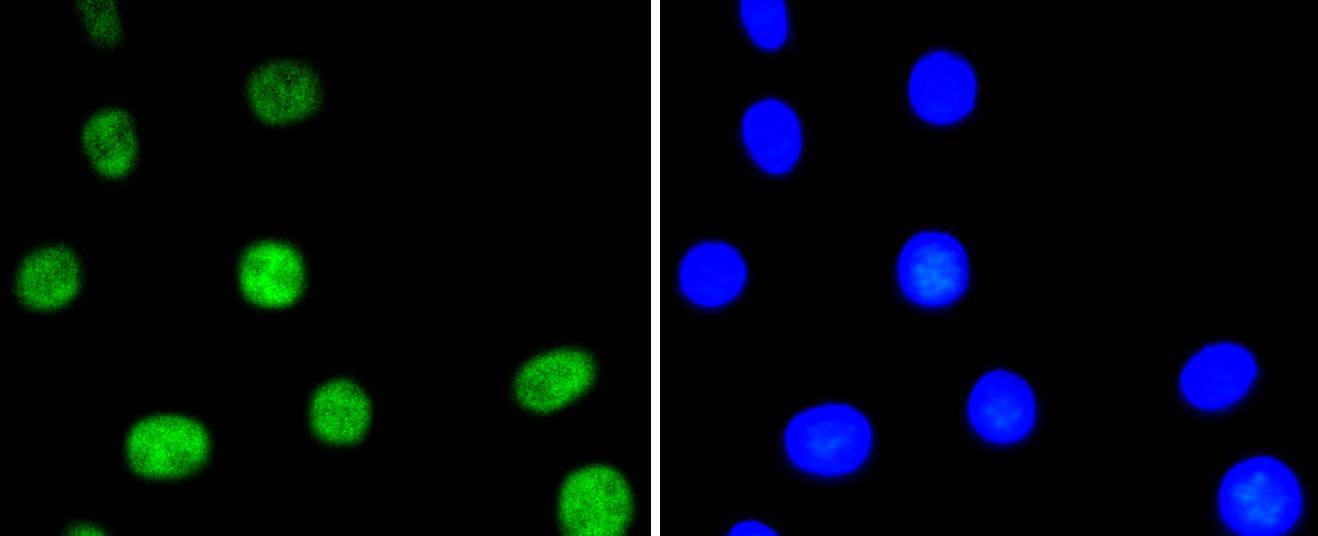 NIH/3T3 cell; 4% Paraformaldehyde-fixed; Triton X-100 at room temperature for 20 min; Blocking buffer (normal goat serum) at 37°C for 20 min; Antibody incubation with (Phospho-ATF2(T71)) Monoclonal Antibody, Unconjugated (bsm-54546R) 1:50, 90 minutes at 37°C; followed by a conjugated Goat Anti-Rabbit IgG antibody at 37°C for 90 minutes, DAPI (blue) was used to stain the cell nuclei.