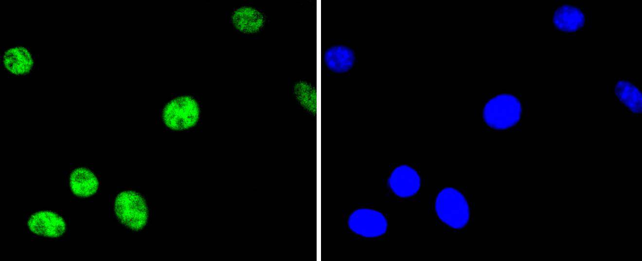 SH-SY5Y cell; 4% Paraformaldehyde-fixed; Triton X-100 at room temperature for 20 min; Blocking buffer (normal goat serum) at 37°C for 20 min; Antibody incubation with (Phospho-ATF2(T71)) Monoclonal Antibody, Unconjugated (bsm-54546R) 1:50, 90 minutes at 37°C; followed by a conjugated Goat Anti-Rabbit IgG antibody at 37°C for 90 minutes, DAPI (blue) was used to stain the cell nuclei.