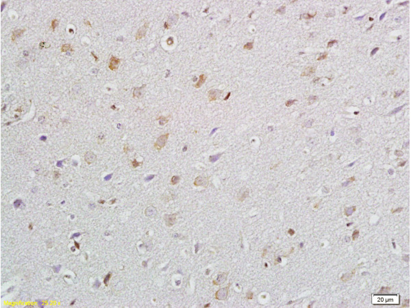 Formalin-fixed and paraffin embedded rat brain labeled with Anti P45017A1/Cytochrome P450 17A1 Polyclonal Antibody, Unconjugated (bs-6720R) at 1:200 followed by conjugation to the secondary antibody and DAB staining