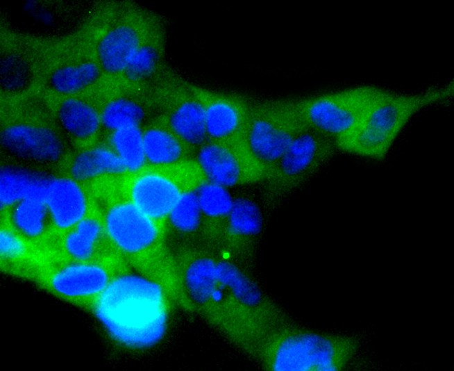 293 cell; 4% Paraformaldehyde-fixed; Triton X-100 at room temperature for 20 min; Blocking buffer (normal goat serum) at 37°C for 20 min; Antibody incubation with (ACE2) Monoclonal Antibody, Unconjugated (bsm-54571R) 1:50, 90 minutes at 37°C; followed by a conjugated Goat Anti-Rabbit IgG antibody at 37°C for 90 minutes, DAPI (blue) was used to stain the cell nuclei.