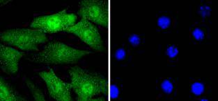 NIH/3T3 cell; 4% Paraformaldehyde-fixed; Triton X-100 at room temperature for 20 min; Blocking buffer (normal goat serum) at 37°C for 20 min; Antibody incubation with (Cyclin E2) Monoclonal Antibody, Unconjugated (bsm-54580R) 1:50, 90 minutes at 37°C; followed by a conjugated Goat Anti-Rabbit IgG antibody at 37°C for 90 minutes, DAPI (blue) was used to stain the cell nuclei.