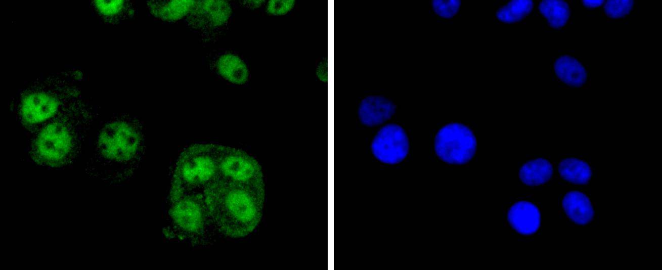 MCF7 cell; 4% Paraformaldehyde-fixed; Triton X-100 at room temperature for 20 min; Blocking buffer (normal goat serum) at 37°C for 20 min; Antibody incubation with (Cyclin E2) Monoclonal Antibody, Unconjugated (bsm-54580R) 1:50, 90 minutes at 37°C; followed by a conjugated Goat Anti-Rabbit IgG antibody at 37°C for 90 minutes, DAPI (blue) was used to stain the cell nuclei.