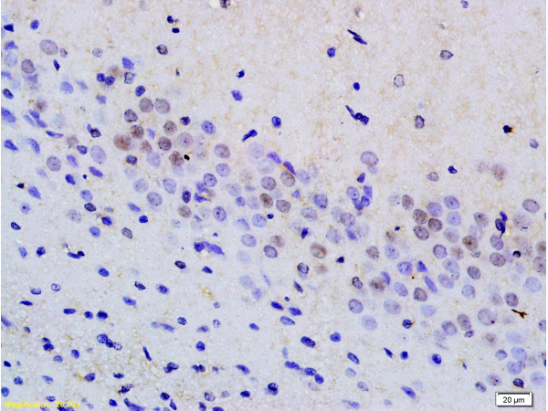 Formalin-fixed and paraffin embedded rat brain tissue labeled with Anti phospho-MAP3K9+MAP3K10(Thr312+Thr266) Polyclonal Antibody, Unconjugated (bs-6779R) at 1:200 followed by conjugation to the secondary antibody and DAB staining