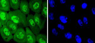 A431 cell; 4% Paraformaldehyde-fixed; Triton X-100 at room temperature for 20 min; Blocking buffer (normal goat serum) at 37°C for 20 min; Antibody incubation with (Phospho-EGFR(Y1068)) Monoclonal Antibody, Unconjugated (bsm-54587R) 1:50, 90 minutes at 37°C; followed by a conjugated Goat Anti-Rabbit IgG antibody at 37°C for 90 minutes, DAPI (blue) was used to stain the cell nuclei. A431 cell; 4% Paraformaldehyde-fixed; Triton X-100 at room temperature for 20 min; Blocking buffer (normal goat serum) at 37°C for 20 min; Antibody incubation with (Phospho-EGFR(Y1068)) Monoclonal Antibody, Unconjugated (bsm-54587R) 1:50, 90 minutes at 37°C; followed by a conjugated Goat Anti-Rabbit IgG antibody at 37°C for 90 minutes, DAPI (blue) was used to stain the cell nuclei.