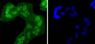 Hela cell; 4% Paraformaldehyde-fixed; Triton X-100 at room temperature for 20 min; Blocking buffer (normal goat serum) at 37°C for 20 min; Antibody incubation with (Phospho-EGFR(Y1068)) Monoclonal Antibody, Unconjugated (bsm-54587R) 1:50, 90 minutes at 37°C; followed by a conjugated Goat Anti-Rabbit IgG antibody at 37°C for 90 minutes, DAPI (blue) was used to stain the cell nuclei.