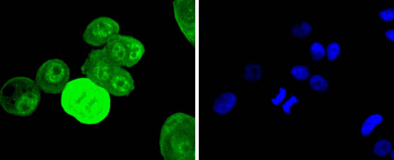 MCF7 cell; 4% Paraformaldehyde-fixed; Triton X-100 at room temperature for 20 min; Blocking buffer (normal goat serum) at 37°C for 20 min; Antibody incubation with (Phospho-EGFR(Y1068)) Monoclonal Antibody, Unconjugated (bsm-54587R) 1:50, 90 minutes at 37°C; followed by a conjugated Goat Anti-Rabbit IgG antibody at 37°C for 90 minutes, DAPI (blue) was used to stain the cell nuclei.