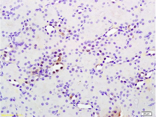 Formalin-fixed and paraffin embedded rat kidney tissue labeled with Anti phospho-MAP3K9+MAP3K10(Thr312+Thr266) Polyclonal Antibody, Unconjugated (bs-6779R) at 1:200 followed by conjugation to the secondary antibody and DAB staining