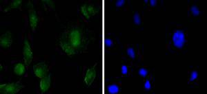 SH-SY5Y cell; 4% Paraformaldehyde-fixed; Triton X-100 at room temperature for 20 min; Blocking buffer (normal goat serum) at 37°C for 20 min; Antibody incubation with (SOX11) polyclonal Antibody, Unconjugated (bsm-54605R) 1:50, 90 minutes at 37°C; followed by a conjugated Goat Anti-Rabbit IgG antibody at 37°C for 90 minutes, DAPI (blue) was used to stain the cell nuclei.