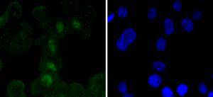 N2A cell; 4% Paraformaldehyde-fixed; Triton X-100 at room temperature for 20 min; Blocking buffer (normal goat serum) at 37°C for 20 min; Antibody incubation with (SOX11) polyclonal Antibody, Unconjugated (bsm-54605R) 1:50, 90 minutes at 37°C; followed by a conjugated Goat Anti-Rabbit IgG antibody at 37°C for 90 minutes, DAPI (blue) was used to stain the cell nuclei.
