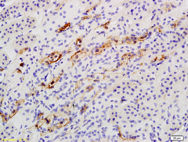 Formalin-fixed and paraffin embedded rat kidney labeled with Anti Catalase Polyclonal Antibody, Unconjugated (bs-6874R) followed by conjugation to the secondary antibody and DAB staining