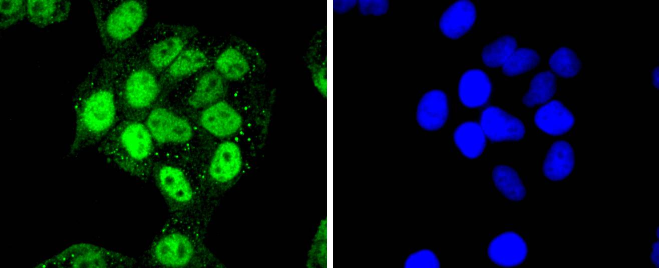 A431 cell; 4% Paraformaldehyde-fixed; Triton X-100 at room temperature for 20 min; Blocking buffer (normal goat serum) at 37°C for 20 min; Antibody incubation with (Cdk7) polyclonal Antibody, Unconjugated (bsm-54616R) 1:50, 90 minutes at 37°C; followed by a conjugated Goat Anti-Rabbit IgG antibody at 37°C for 90 minutes, DAPI (blue) was used to stain the cell nuclei.