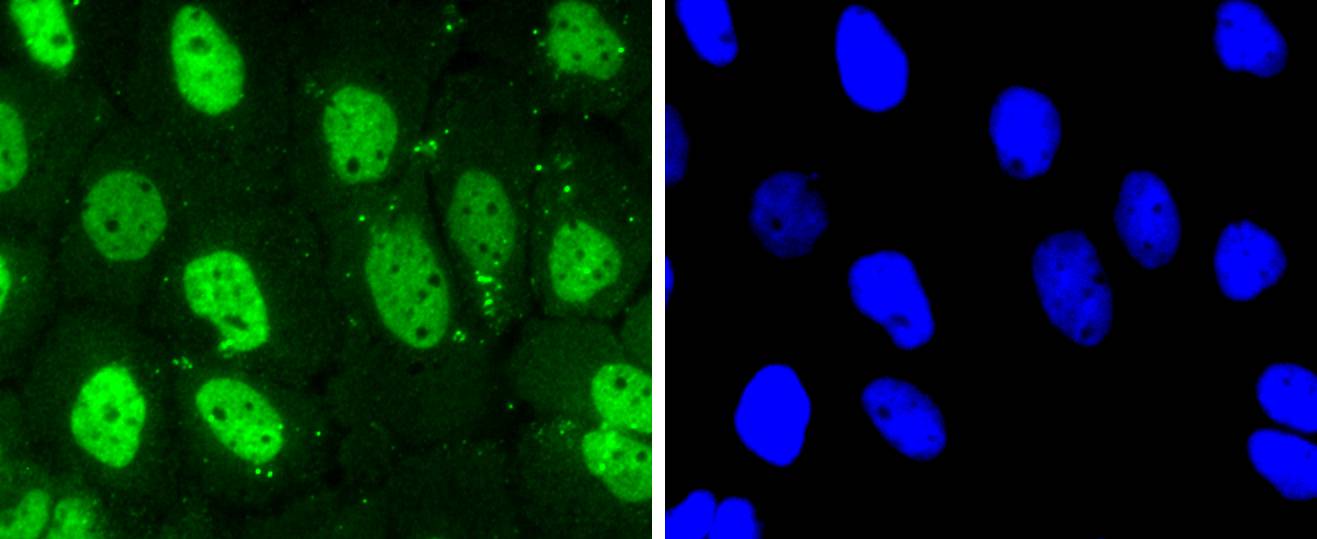 Hela cell; 4% Paraformaldehyde-fixed; Triton X-100 at room temperature for 20 min; Blocking buffer (normal goat serum) at 37°C for 20 min; Antibody incubation with (Cdk7) polyclonal Antibody, Unconjugated (bsm-54616R) 1:50, 90 minutes at 37°C; followed by a conjugated Goat Anti-Rabbit IgG antibody at 37°C for 90 minutes, DAPI (blue) was used to stain the cell nuclei.