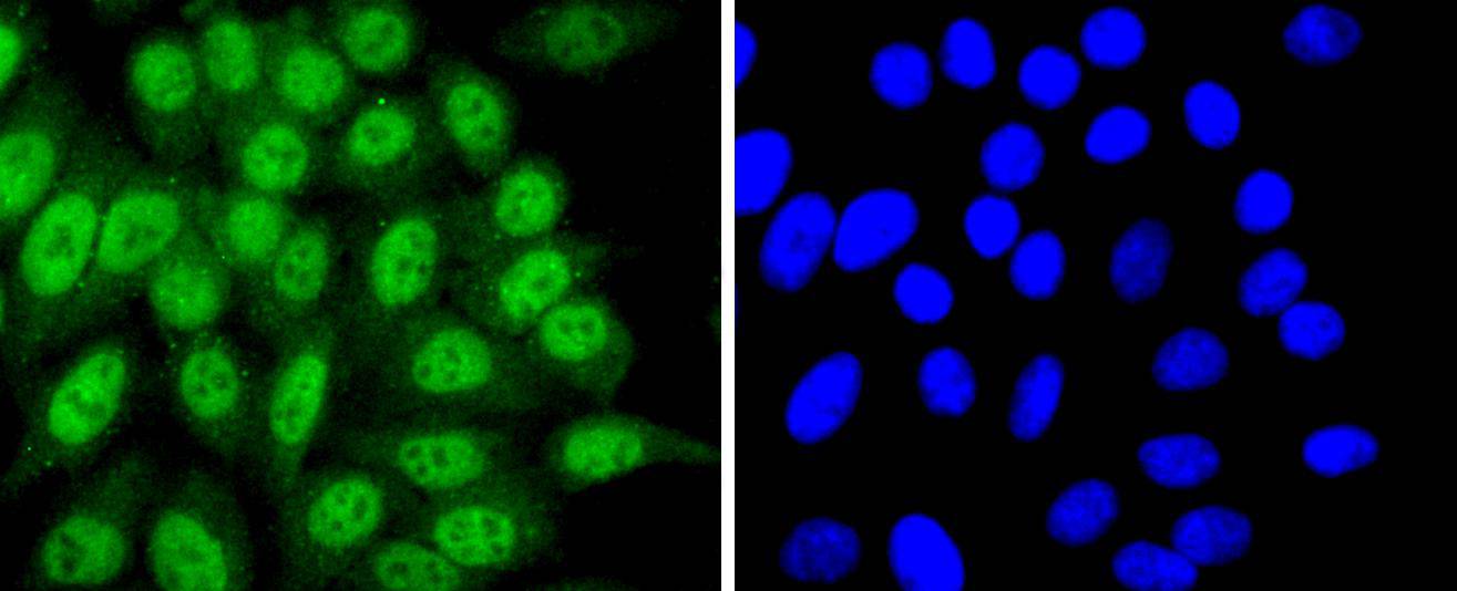 HepG2 cell; 4% Paraformaldehyde-fixed; Triton X-100 at room temperature for 20 min; Blocking buffer (normal goat serum) at 37°C for 20 min; Antibody incubation with (Cdk7) polyclonal Antibody, Unconjugated (bsm-54616R) 1:50, 90 minutes at 37°C; followed by a conjugated Goat Anti-Rabbit IgG antibody at 37°C for 90 minutes, DAPI (blue) was used to stain the cell nuclei.