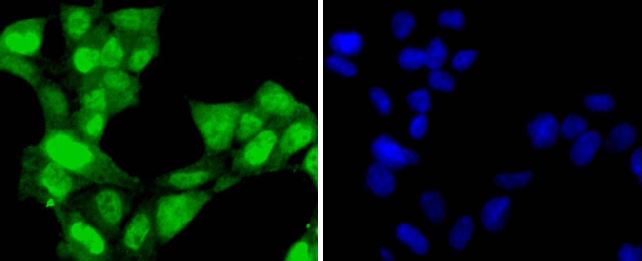 293 cell; 4% Paraformaldehyde-fixed; Triton X-100 at room temperature for 20 min; Blocking buffer (normal goat serum) at 37°C for 20 min; Antibody incubation with (Cdk7) polyclonal Antibody, Unconjugated (bsm-54616R) 1:50, 90 minutes at 37°C; followed by a conjugated Goat Anti-Rabbit IgG antibody at 37°C for 90 minutes, DAPI (blue) was used to stain the cell nuclei.