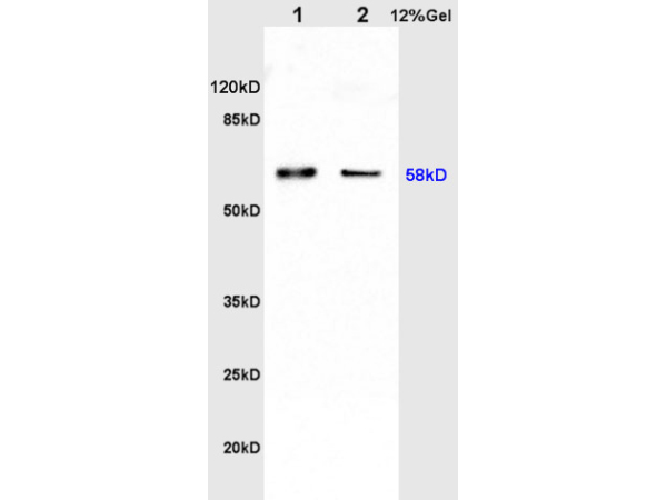L1 rat kidney lysates L2 rat brain lysates probed with Anti Catalase Polyclonal Antibody, Unconjugated (bs-6874R) at 1:200 in 4˚C. Followed by conjugation to secondary antibody (bs-0295G-HRP) at 1:3000 90min in 37˚C. Predicted band 58kD. Observed band size: 58kD