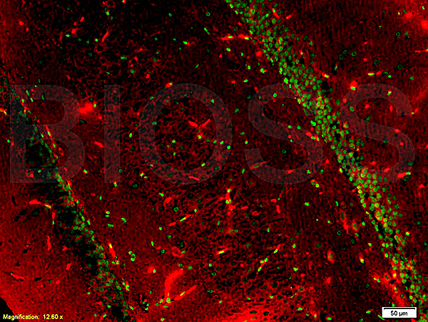Formalin-fixed and paraffin embedded rat brain tissue labeled with Anti-BrdU(A7) Monoclonal Antibody, Unconjugated (bsm-0917M)  at 1:200, followed by conjugation to the secondary antibody and DAB staining