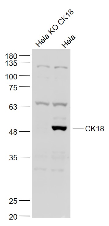 Lane 1: Human Hela KO CK18 cell lysates; Lane 2: Human Hela cell lysates probed with CK18 Polyclonal Antibody, Unconjugated (bs-1339R) at 1:1000 dilution and 4˚C overnight incubation. Followed by conjugated secondary antibody incubation at 1:20000 for 60 min at 37˚C.