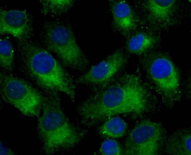 A549 cell; 4% Paraformaldehyde-fixed; Triton X-100 at room temperature for 20 min; Blocking buffer (normal goat serum) at 37°C for 20 min; Antibody incubation with (Nogo) Monoclonal Antibody, Unconjugated (bsm-54643R) 1:100, 90 minutes at 37°C; followed by a conjugated Goat Anti-Rabbit IgG antibody at 37°C for 90 minutes, DAPI (blue) was used to stain the cell nuclei.