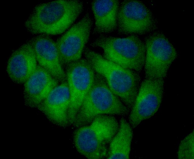 HepG2 cell; 4% Paraformaldehyde-fixed; Triton X-100 at room temperature for 20 min; Blocking buffer (normal goat serum) at 37°C for 20 min; Antibody incubation with (Nogo) Monoclonal Antibody, Unconjugated (bsm-54643R) 1:100, 90 minutes at 37°C; followed by a conjugated Goat Anti-Rabbit IgG antibody at 37°C for 90 minutes, DAPI (blue) was used to stain the cell nuclei.