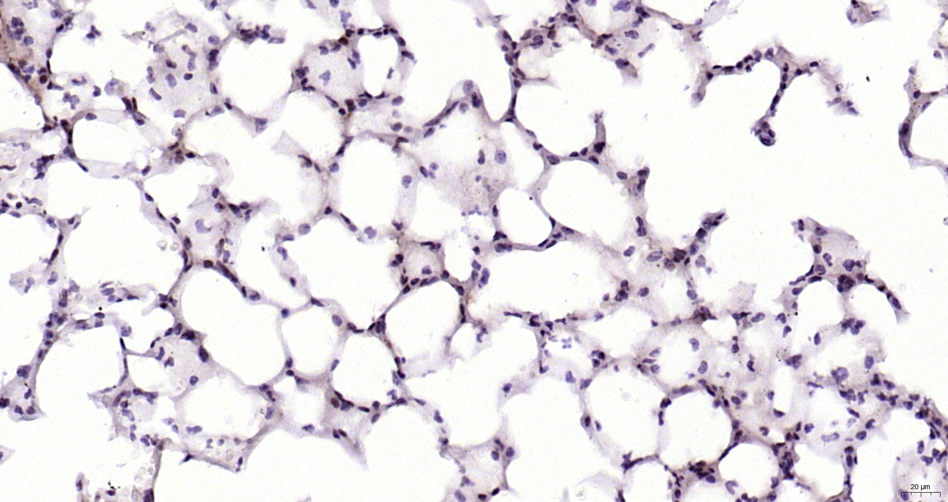 Paraformaldehyde-fixed, paraffin embedded Mouse lung; Antigen retrieval by boiling in sodium citrate buffer (pH6.0) for 15min; Block endogenous peroxidase by 3% hydrogen peroxide for 20 minutes; Blocking buffer (normal goat serum) at 37°C for 30min; Antibody incubation with Histone H1 (Lys52) Polyclonal Antibody, Unconjugated (bs-0931R) at 1:200 overnight at 4°C, DAB staining.