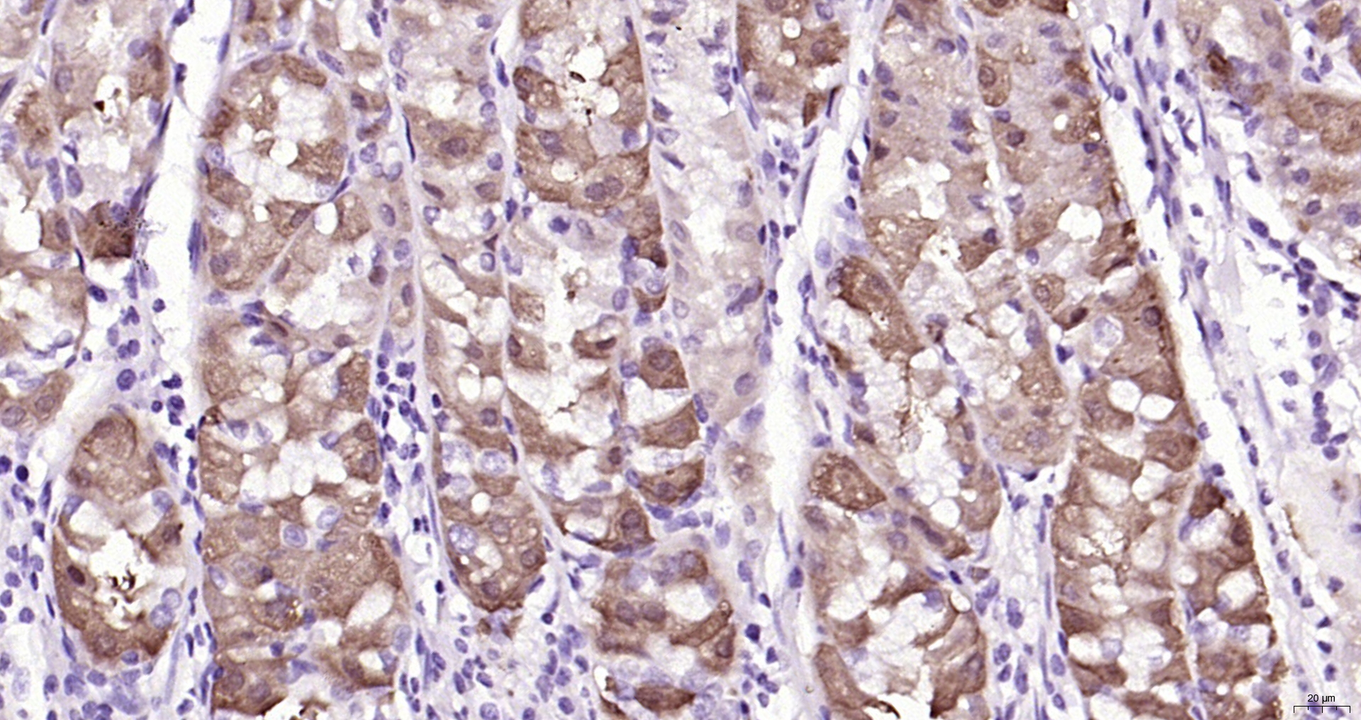 Paraformaldehyde-fixed, paraffin embedded Human stomach; Antigen retrieval by boiling in sodium citrate buffer (pH6.0) for 15min; Block endogenous peroxidase by 3% hydrogen peroxide for 20 minutes; Blocking buffer (normal goat serum) at 37°C for 30min; Antibody incubation with APG5L Polyclonal Antibody, Unconjugated (bs-4005R) at 1:200 overnight at 4°C, DAB staining.