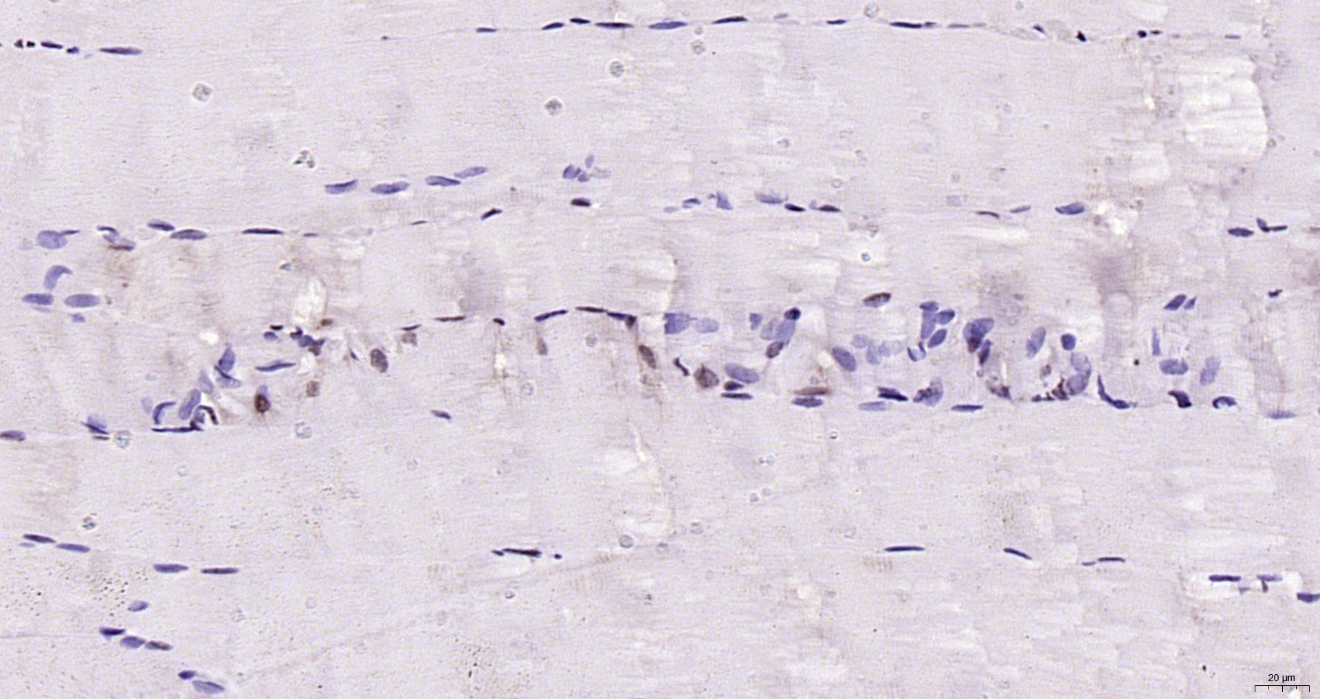 Paraformaldehyde-fixed, paraffin embedded Rat muscle; Antigen retrieval by boiling in sodium citrate buffer (pH6.0) for 15min; Block endogenous peroxidase by 3% hydrogen peroxide for 20 minutes; Blocking buffer (normal goat serum) at 37°C for 30min; Antibody incubation with MYF5 Polyclonal Antibody, Unconjugated (bs-6936R) at 1:200 overnight at 4°C, DAB staining.