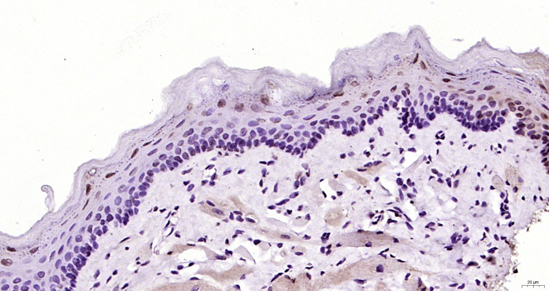 Paraformaldehyde-fixed, paraffin embedded Rat tongue; Antigen retrieval by boiling in sodium citrate buffer (pH6.0) for 15min; Block endogenous peroxidase by 3% hydrogen peroxide for 20 minutes; Blocking buffer (normal goat serum) at 37°C for 30min; Antibody incubation with MYF5 Polyclonal Antibody, Unconjugated (bs-6936R) at 1:200 overnight at 4°C, DAB staining.