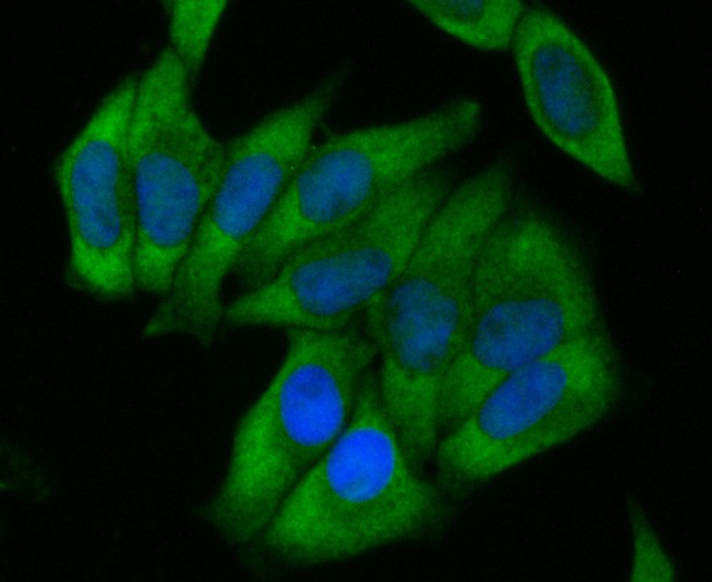 Hela cell; 4% Paraformaldehyde-fixed; Triton X-100 at room temperature for 20 min; Blocking buffer (normal goat serum) at 37°C for 20 min; Antibody incubation with (ACADM) Monoclonal Antibody, Unconjugated (bsm-54662R) 1:50, 90 minutes at 37°C; followed by a conjugated Goat Anti-Rabbit IgG antibody at 37°C for 90 minutes, DAPI (blue) was used to stain the cell nuclei.