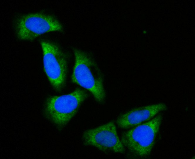 Siha cell; 4% Paraformaldehyde-fixed; Triton X-100 at room temperature for 20 min; Blocking buffer (normal goat serum) at 37°C for 20 min; Antibody incubation with (ACADM ) Monoclonal Antibody, Unconjugated (bsm-54662R) 1:100, 90 minutes at 37°C; followed by a conjugated Goat Anti-Rabbit IgG antibody at 37°C for 90 minutes, DAPI (blue) was used to stain the cell nuclei.