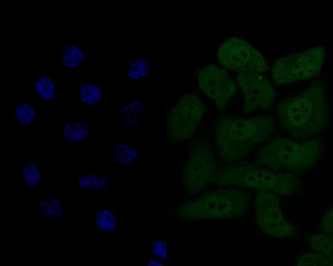 HepG2 cell; 4% Paraformaldehyde-fixed; Triton X-100 at room temperature for 20 min; Blocking buffer (normal goat serum) at 37°C for 20 min; Antibody incubation with (HSF2) Monoclonal Antibody, Unconjugated (bsm-54665R) 1:50, 90 minutes at 37°C; followed by a conjugated Goat Anti-Rabbit IgG antibody at 37°C for 90 minutes, DAPI (blue) was used to stain the cell nuclei.