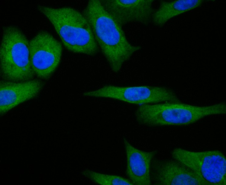 Hela cell; 4% Paraformaldehyde-fixed; Triton X-100 at room temperature for 20 min; Blocking buffer (normal goat serum) at 37°C for 20 min; Antibody incubation with (RSK1 p90) Monoclonal Antibody, Unconjugated (bsm-54668R) 1:50, 90 minutes at 37°C; followed by a conjugated Goat Anti-Rabbit IgG antibody at 37°C for 90 minutes, DAPI (blue) was used to stain the cell nuclei.