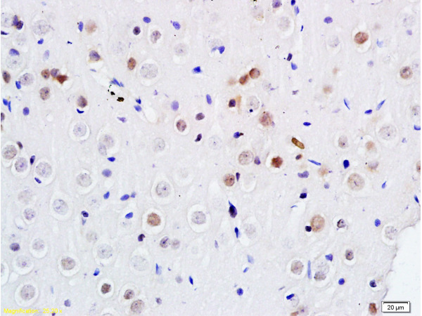 Formalin-fixed and paraffin embedded rat brain labeled with Anti DENTT Polyclonal Antibody, Unconjugated (bs-7051R) at 1:200 followed by conjugation to the secondary antibody and DAB staining