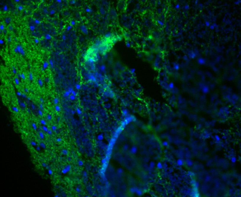 Rat bone marrow cell; 4% Paraformaldehyde-fixed; Triton X-100 at room temperature for 20 min; Blocking buffer (normal goat serum) at 37°C for 20 min; Antibody incubation with (Synapsin II) Monoclonal Antibody, Unconjugated (bsm-54672R) 1:100, 90 minutes at 37°C; followed by a conjugated Goat Anti-Rabbit IgG antibody at 37°C for 90 minutes, DAPI (blue) was used to stain the cell nuclei.