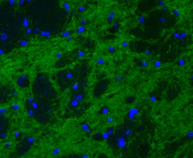 Rat brain cell; 4% Paraformaldehyde-fixed; Triton X-100 at room temperature for 20 min; Blocking buffer (normal goat serum) at 37°C for 20 min; Antibody incubation with (Synapsin II) Monoclonal Antibody, Unconjugated (bsm-54672R) 1:100, 90 minutes at 37°C; followed by a conjugated Goat Anti-Rabbit IgG antibody at 37°C for 90 minutes, DAPI (blue) was used to stain the cell nuclei.
