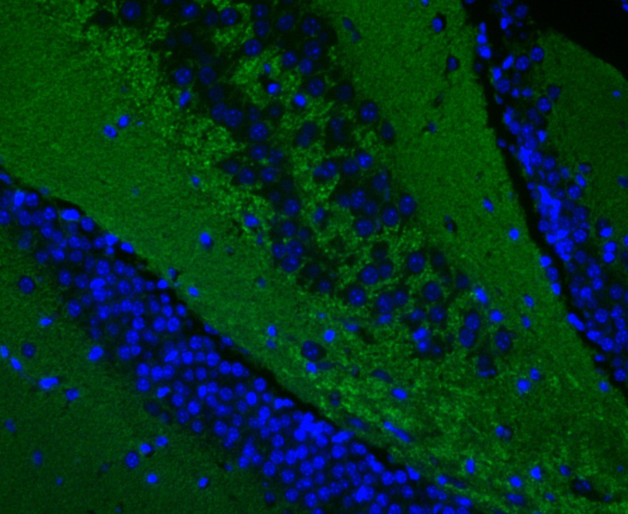 Mouse brain cell; 4% Paraformaldehyde-fixed; Triton X-100 at room temperature for 20 min; Blocking buffer (normal goat serum) at 37°C for 20 min; Antibody incubation with (Synapsin II) Monoclonal Antibody, Unconjugated (bsm-54672R) 1:100, 90 minutes at 37°C; followed by a conjugated Goat Anti-Rabbit IgG antibody at 37°C for 90 minutes, DAPI (blue) was used to stain the cell nuclei.