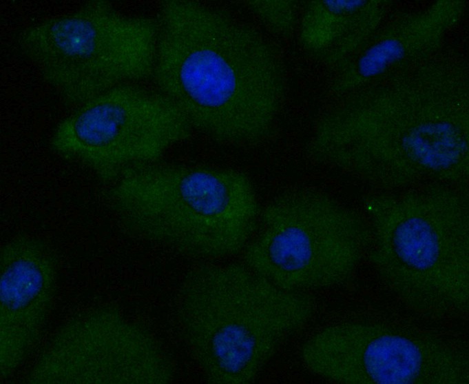 Hela cell; 4% Paraformaldehyde-fixed; Triton X-100 at room temperature for 20 min; Blocking buffer (normal goat serum) at 37°C for 20 min; Antibody incubation with (APRIL/TNFSF13) Monoclonal Antibody, Unconjugated (bsm-54673R) 1:50, 90 minutes at 37°C; followed by a conjugated Goat Anti-Rabbit IgG antibody at 37°C for 90 minutes, DAPI (blue) was used to stain the cell nuclei.